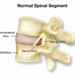 Spinal segment showing vertebra and disc